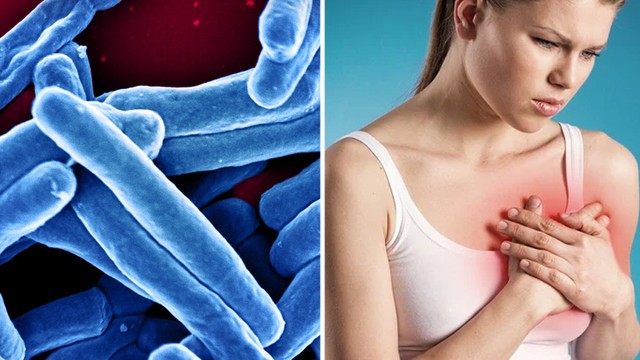 bai-viet/lao-vu-co-lay-khong-cach-phong-ngua-benh-lao-vu-hieu-qua.html