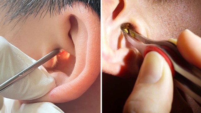 bai-viet/lay-ray-tai-noi-soi-co-an-toan-khong-nhung-dieu-can-luu-y.html