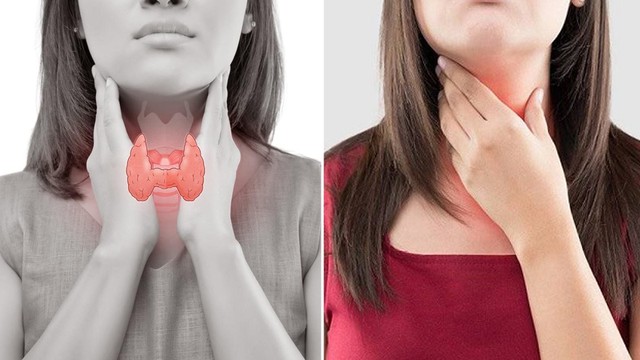 bai-viet/nhan-thuy-phai-tuyen-giap-tirads-3-la-gi-cac-phuong-phap-dieu-tri.html