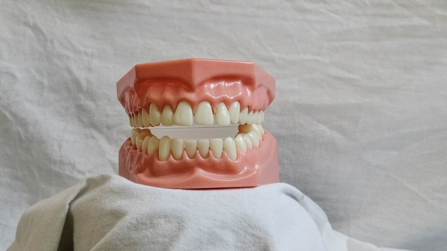 bai-viet/rang-su-ddbio-co-tot-khong-gia-bao-nhieu.html