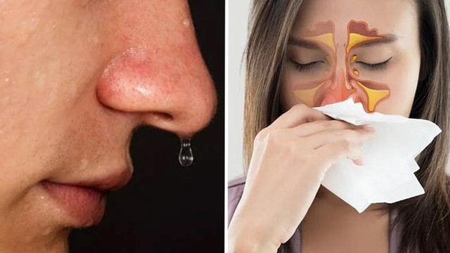 bai-viet/ro-dich-nao-tuy-la-gi-co-nguy-hiem-khong.html