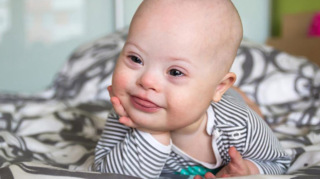 bai-viet/sieu-am-thai-nhi-mui-tet-va-moi-lien-he-voi-hoi-chung-down.html