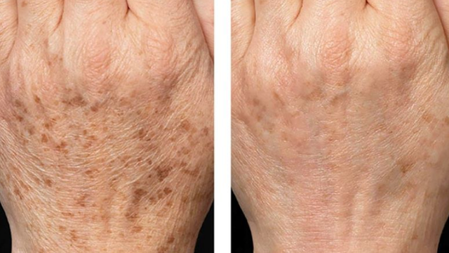 bai-viet/tang-sac-to-da-o-tay-la-do-nhung-nguyen-nhan-nao-cach-nhan-biet.html