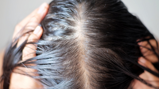 bai-viet/toc-bet-la-gi-lam-the-nao-de-han-che-tinh-trang-nay.html