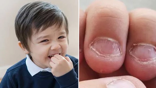 bai-viet/tre-hay-can-mong-tay-la-thieu-chat-gi-bo-sung-sao-cho-hieu-qua.html