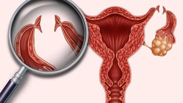 bai-viet/tuoi-tho-cua-nguoi-cat-tu-cung-va-buong-trung-duoc-bao-lau.html