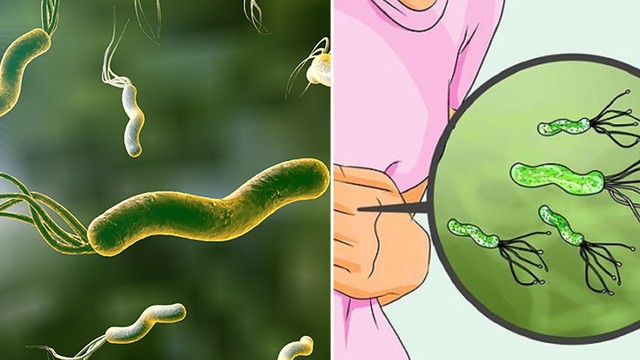 bai-viet/dieu-tri-vi-khuan-hp-khang-thuoc-the-nao-cho-dung.html