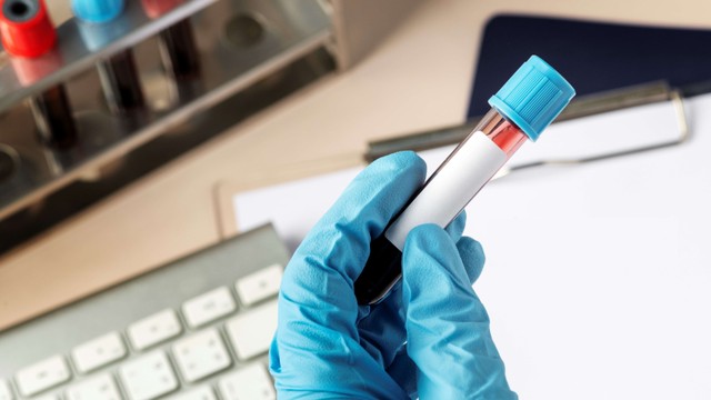 bai-viet/xet-nghiem-khang-the-covid-o-dau-dang-tin-cay-va-chat-luong.html