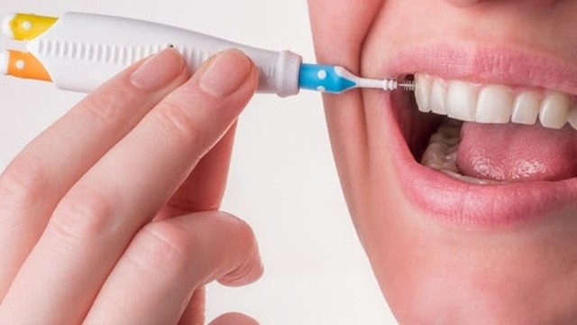 bai-viet/tam-chi-ke-rang-ban-chai-ke-rang-loai-nao-tot-59708.html