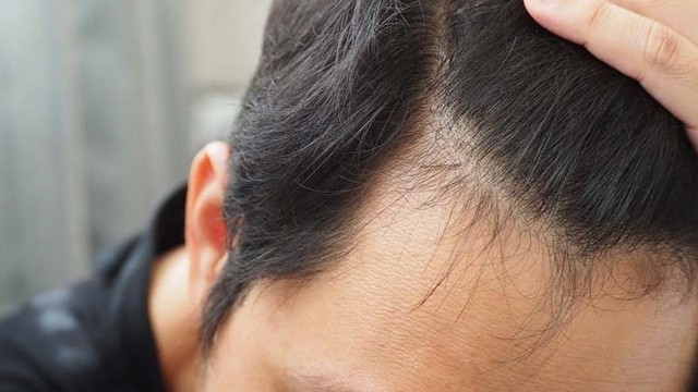 bai-viet/ban-da-biet-cac-dau-hieu-toc-moc-lai-chua.html