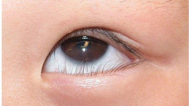 bai-viet/ban-da-biet-cach-nho-long-mi-quam-chinh-xac-chua.html