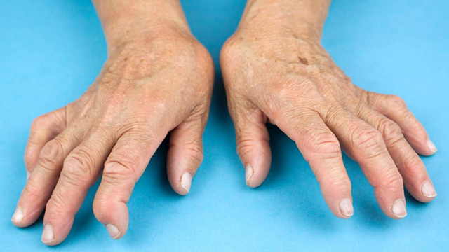 bai-viet/ban-tay-gio-thoi-la-bien-chung-cua-benh-gi-do-nguyen-nhan-nao.html