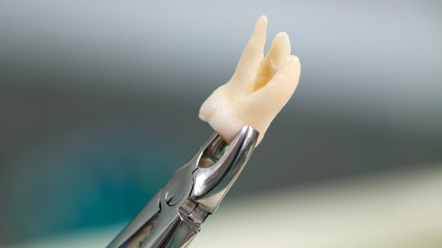 bai-viet/bang-gia-nho-rang-khon-cap-nhat-moi-nhat-hien-nay.html