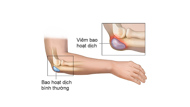 bai-viet/bao-hoat-dich-la-gi-chuc-nang-cua-bao-hoat-dich.html