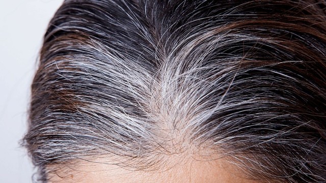 bai-viet/bat-mi-cac-cach-khac-phuc-tinh-trang-toc-bac-som.html