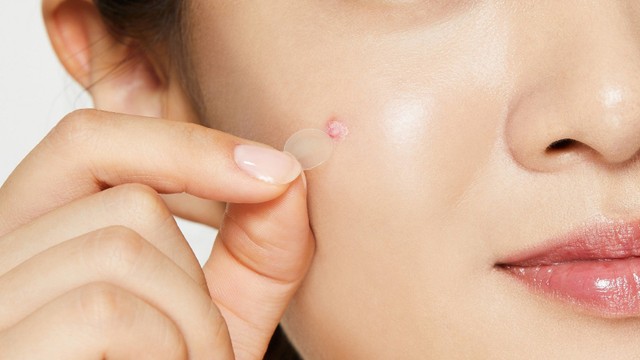 bai-viet/bat-mi-diem-noi-bat-cua-mieng-dan-mun-ban-ngay-derma-angel.html