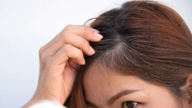 bai-viet/mot-so-thuc-pham-ho-tro-phong-ngua-toc-bac-som-hieu-qua.html