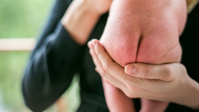 bai-viet/be-bi-ham-ta-nang-nguyen-nhan-va-cach-dieu-tri-59906.html