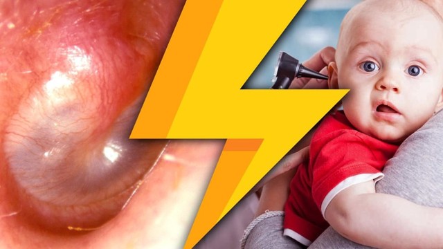 bai-viet/be-bi-viem-tai-giua-phai-lam-sao-cho-nhanh-khoi.html