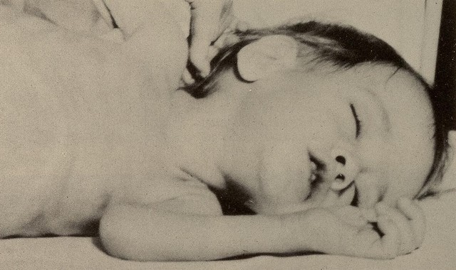 bai-viet/benh-niemann-pick-nguyen-nhan-trieu-chung-va-huong-dieu-tri.html