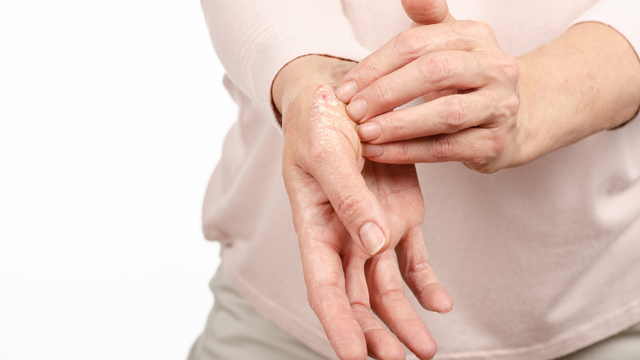 benh/a-sung-512.html