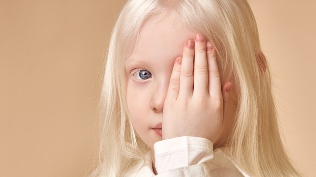 bai-viet/benh-bach-tang-song-duoc-bao-lau-nguyen-nhan-dan-den-benh-bach-tang-68763.html