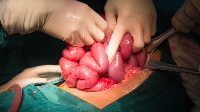 bai-viet/benh-crohn-co-lay-khong-dau-hieu-nhan-biet-va-dieu-tri-58108.html