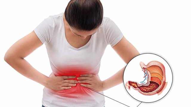 bai-viet/benh-dau-da-day-co-bi-lay-khong.html