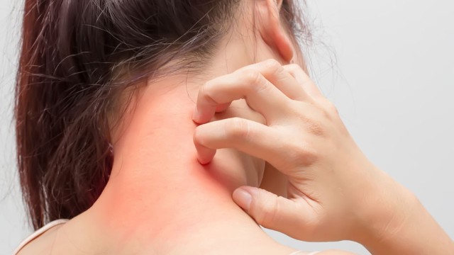 bai-viet/benh-di-ung-kim-loai-do-deo-trang-suc-va-cach-khac-phuc-40549.html