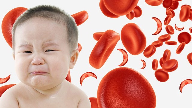 bai-viet/lam-va-sao-de-khac-phuc-skinny-fat-70633.html