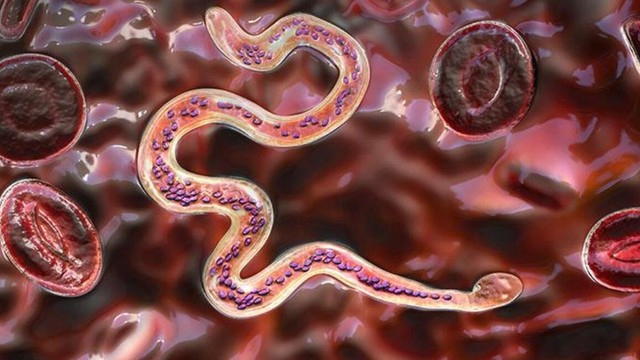 bai-viet/benh-ky-sinh-trung-pho-bien-nhat-o-viet-nam-va-cac-bien-phap-phong-benh.html