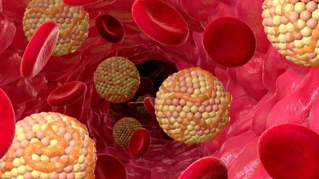 bai-viet/benh-mo-mau-cao-co-chua-khoi-duoc-khong-va-nhung-dieu-can-biet.html