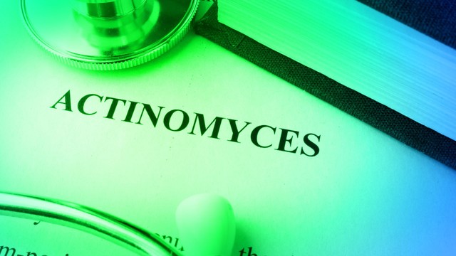 bai-viet/benh-nam-actinomyces-israelii-nguyen-nhan-trieu-chung-va-cach-dieu-tri.html