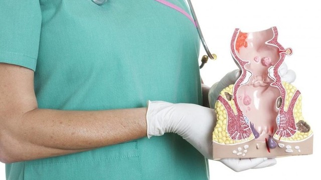 bai-viet/benh-nhan-bi-tri-nen-lam-gi.html