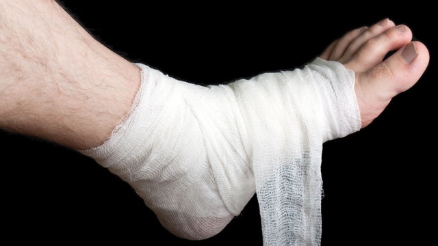 bai-viet/benh-nhan-gay-xuong-ban-chan-bao-lau-thi-di-lai-duoc-65185.html