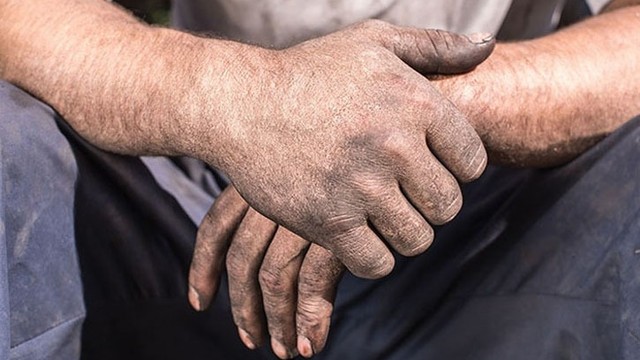 bai-viet/benh-sam-da-nghe-nghiep-la-gi.html