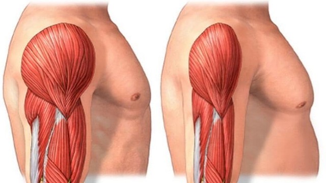 bai-viet/benh-teo-co-delta-dau-hieu-nguyen-nhan-va-giai-phap-can-thiep.html