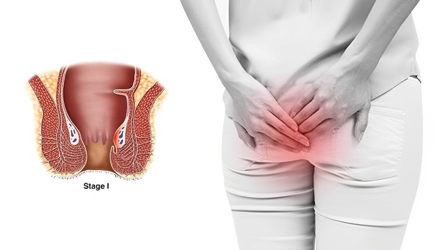 bai-viet/benh-tri-giai-doan-dau-nhan-biet-the-nao-co-tu-khoi-khong.html