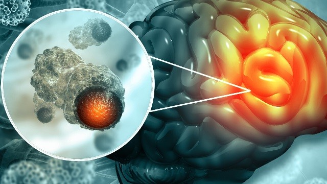 bai-viet/benh-ung-thu-nao-co-lay-khong-bien-phap-phong-tranh-benh-ung-thu-nao.html