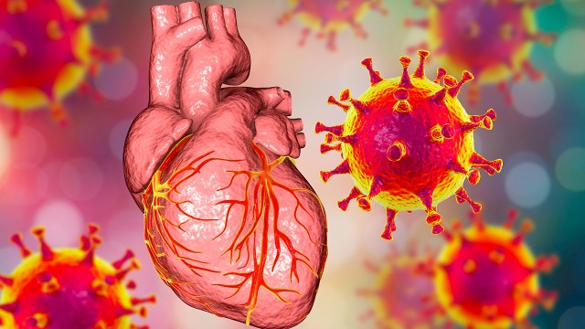 bai-viet/benh-viem-co-tim-co-chua-khoi-duoc-khong.html