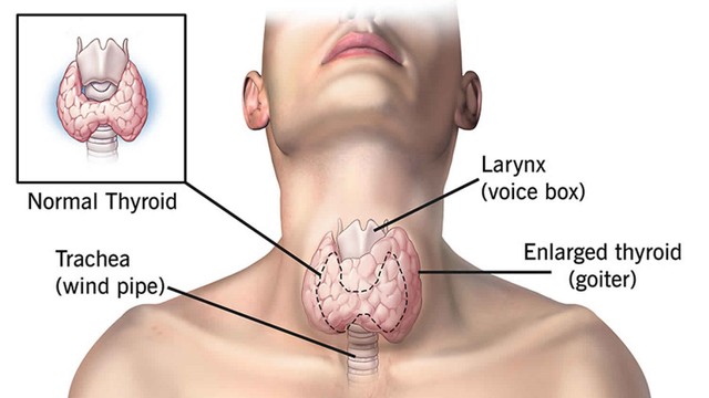 benh/buou-giap-lan-toa.html