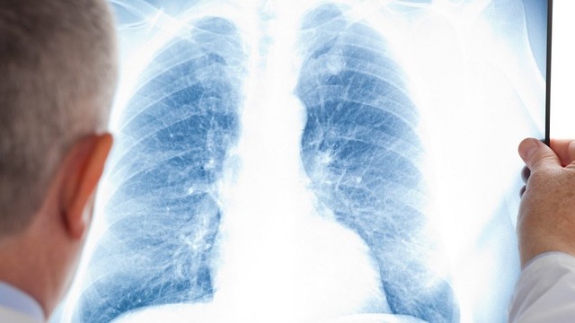 bai-viet/bi-benh-lao-phoi-co-chua-duoc-khong.html