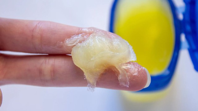 bai-viet/giai-dap-thac-mac-bi-bong-boi-vaseline-duoc-khong.html