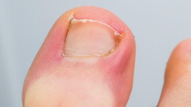 bai-viet/bi-chin-me-kieng-an-gi-8-thuc-pham-gay-nguy-hiem-ban-can-tranh-xa-69468.html