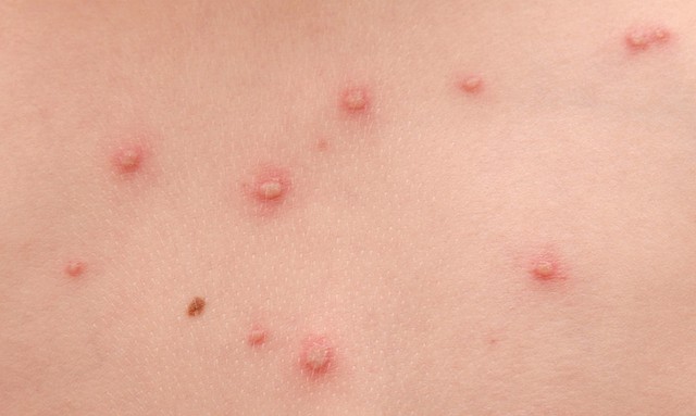 bai-viet/bi-kien-can-sung-mu-co-nguy-hiem-khong-46605.html