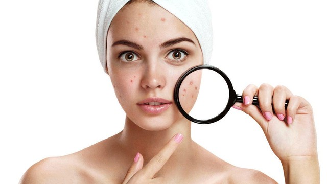 bai-viet/bi-mun-noi-tiet-nen-uong-gi-mau-het-53668.html