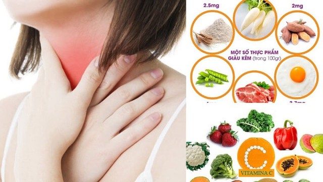 bai-viet/bi-nam-hong-kieng-an-gi-cho-nhanh-khoi-56664.html