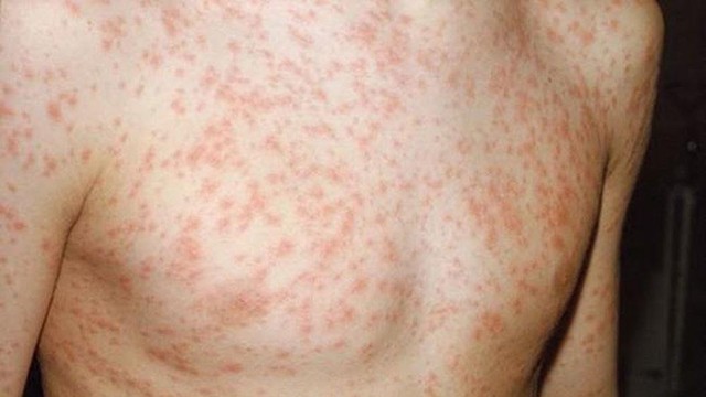 bai-viet/bi-phat-ban-co-nam-may-lanh-duoc-khong.html