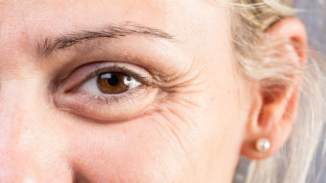 bai-viet/bi-quyet-xoa-nep-nhan-duoi-mat-chi-em-khong-the-bo-qua.html