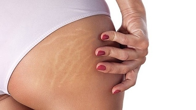 bai-viet/bi-ran-da-mong-mau-trang-chua-the-nao-56577.html